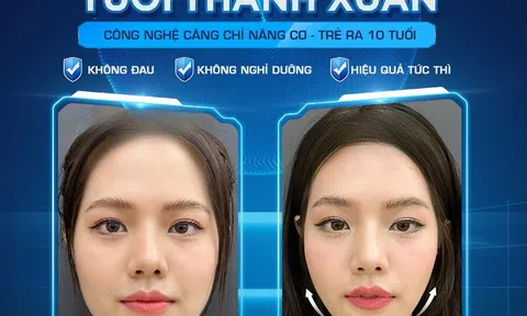 Max V-Lift – Công nghệ cấy sợi sinh học không phẫu thuật được hàng nghìn khách hàng lựa chọn tại Dr. Hoàng Tuấn